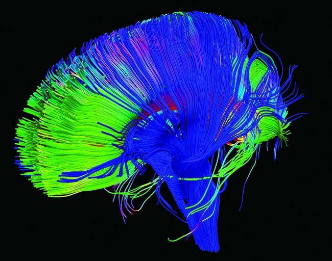 Map of neural activity in the brain